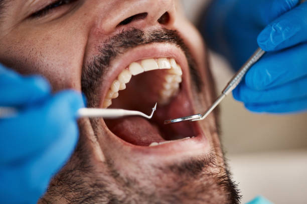 Best Emergency Root Canal Therapy in Vian, OK
