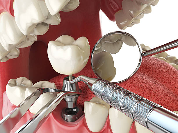 Professional Emergency Dental Service in OK